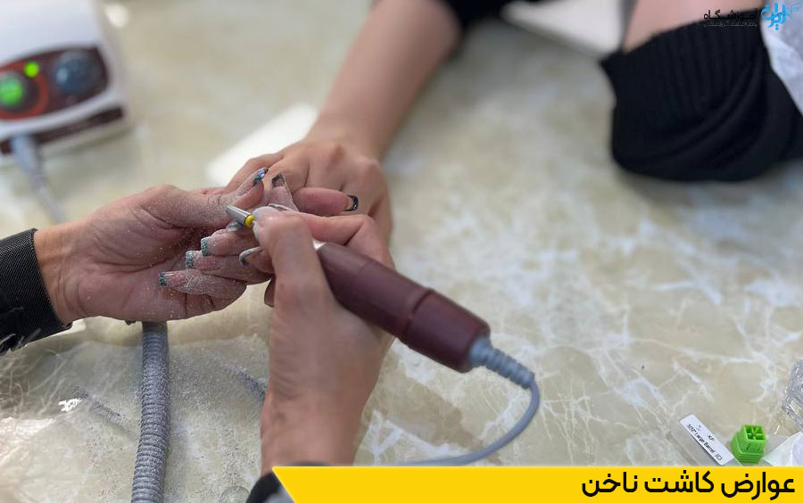 عوارض کاشت ناخن