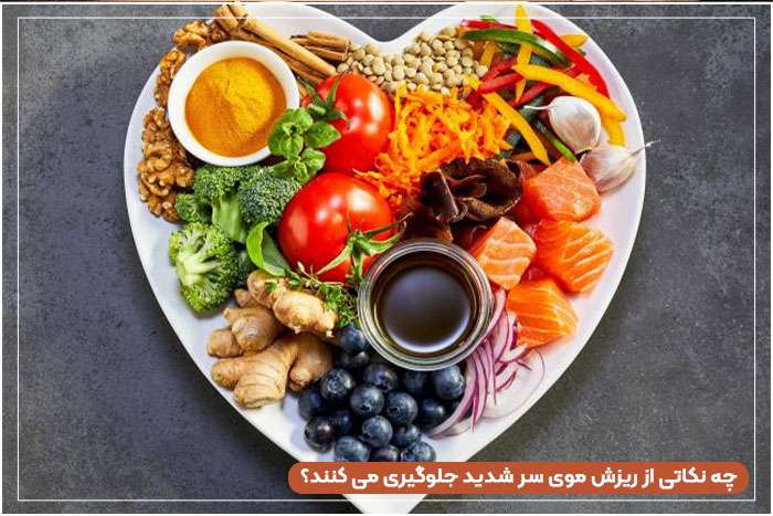 چه نکاتی از ریزش موی سر شدید جلوگیری می کنند؟