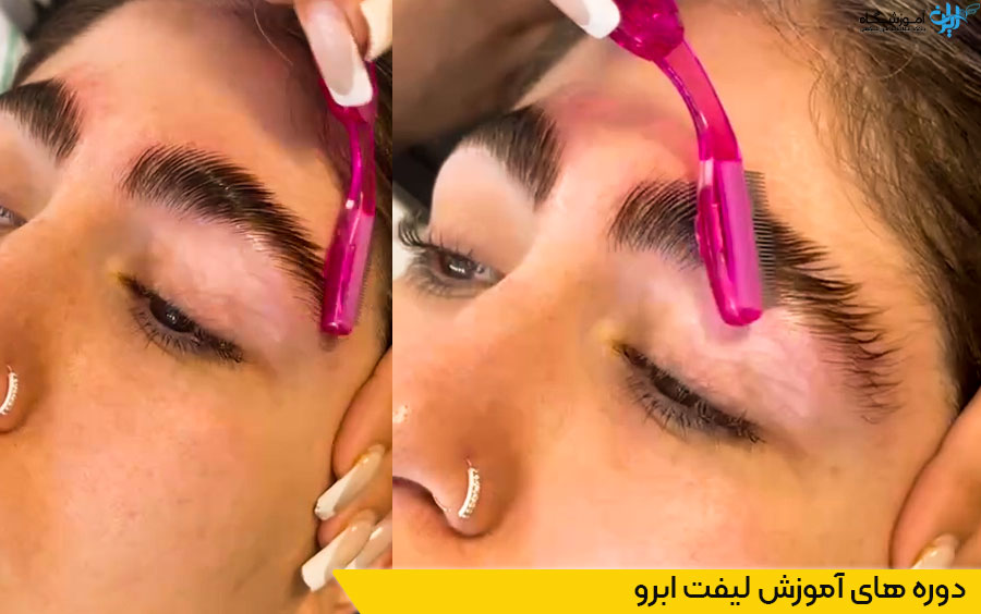 دوره لیفت ابرو خوب