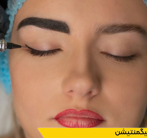 دوره میکروپیگمنتیشن