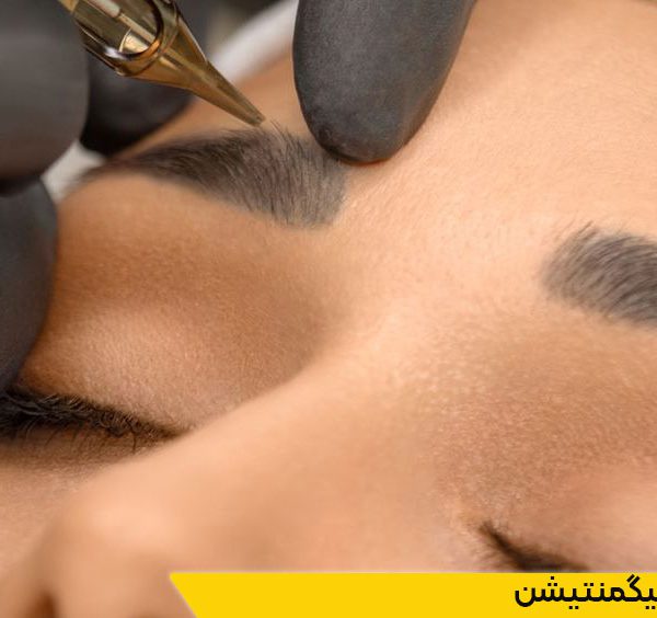 دوره میکروپیگمنتیشن