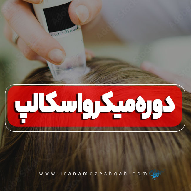 دوره آموزش میکرواسکالپ