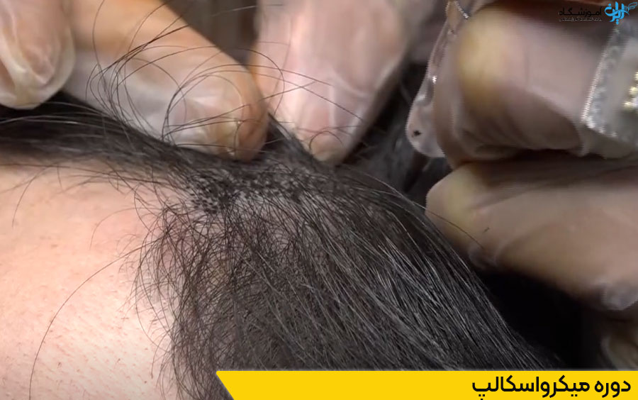 دوره آموزش تاتو سر