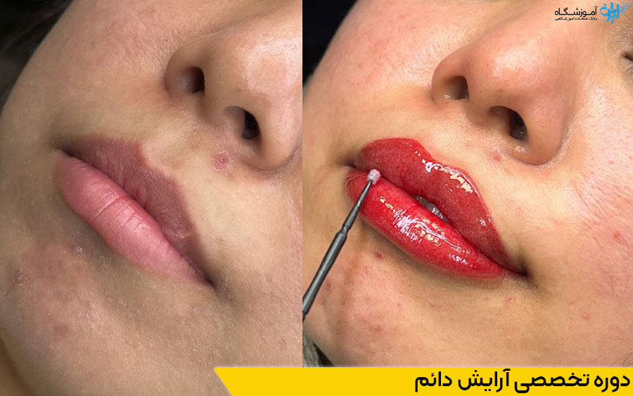 آموزش تاتو صورت