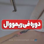 دوره آموزش فی ریمووال