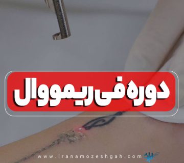 دوره آموزش فی ریمووال