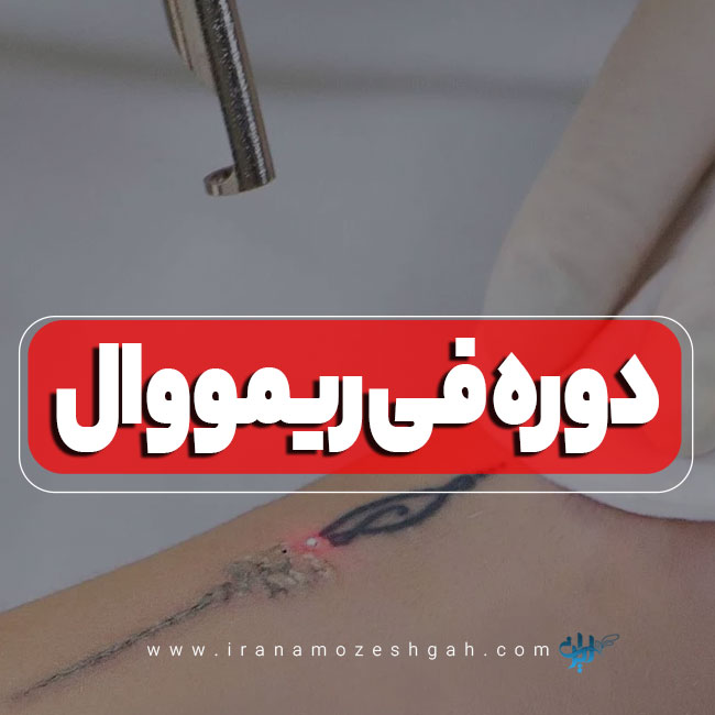 دوره آموزش فی ریمووال