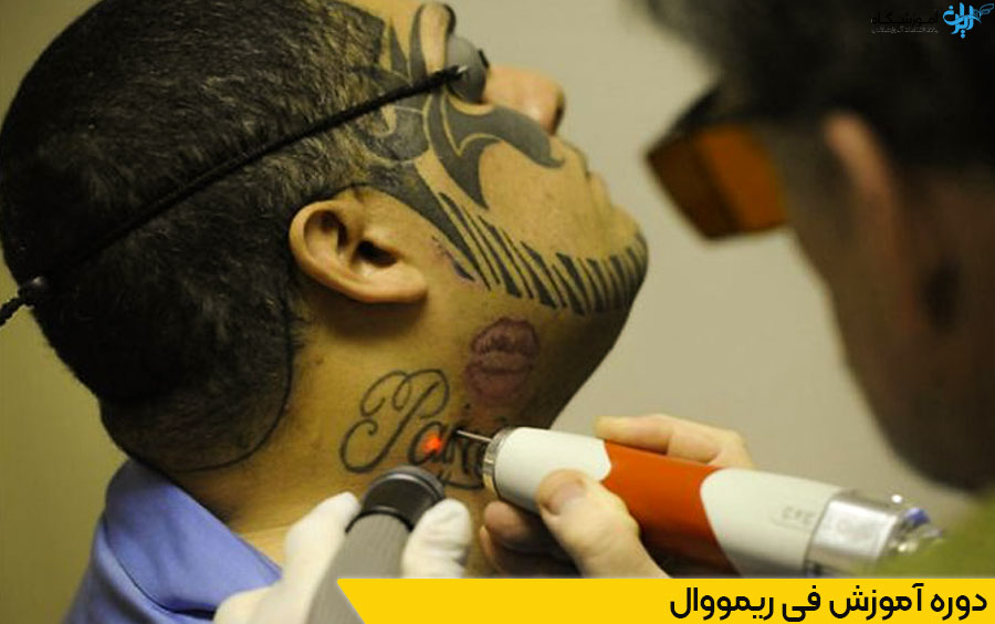 دوره آموزش فی ریمووال