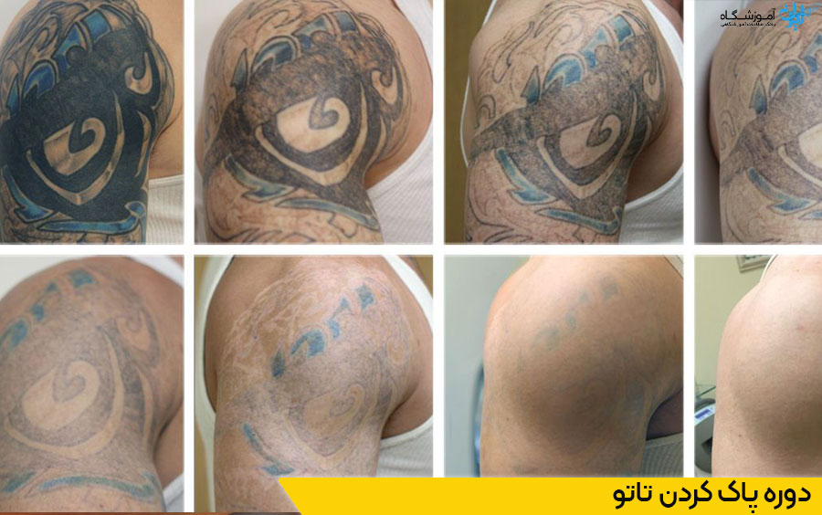 دوره پاک کردن فی ریمووال