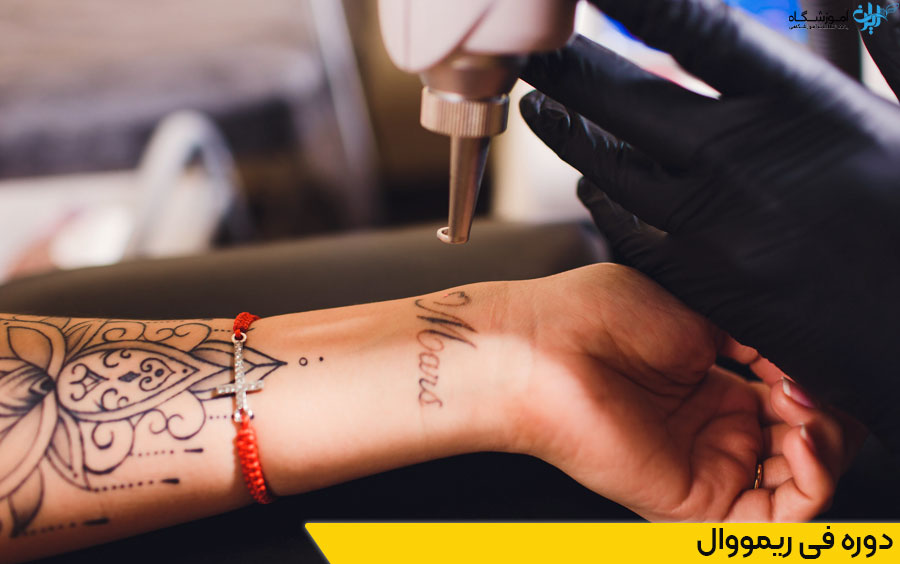 دوره آموزش فی ریمووال