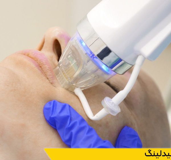 دوره آموزش میکرونیدلینگ