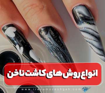 انواع روش کاشت ناخن