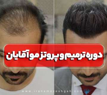 دوره آموزش ترمیم موی سر آقایان تهران