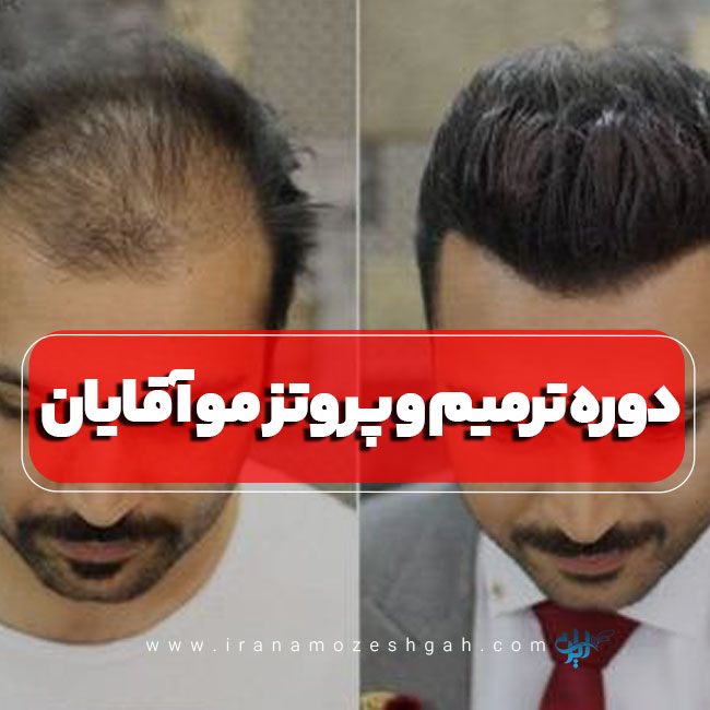 دوره آموزش ترمیم موی سر آقایان تهران