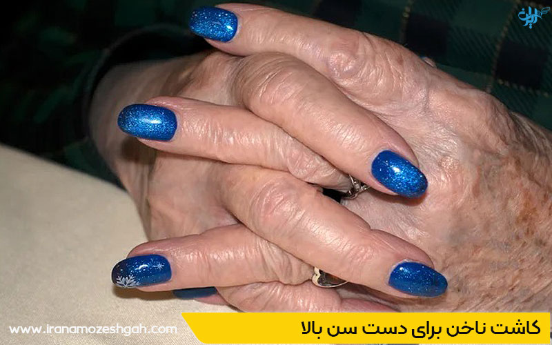طرح ناخن سن بالا