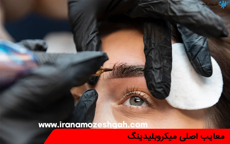 معایب اصلی میکروبلیدینگ