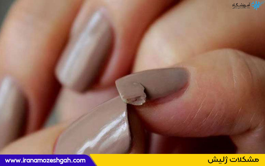 دوام لاک ژل چقدر است