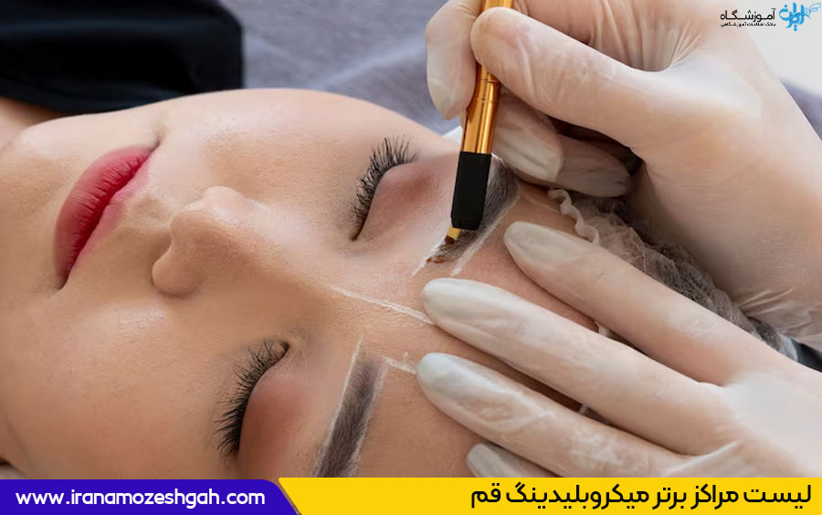 میکروبلیدینگ در قم