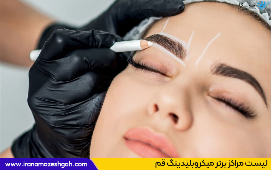 میکروبلیدینگ در قم