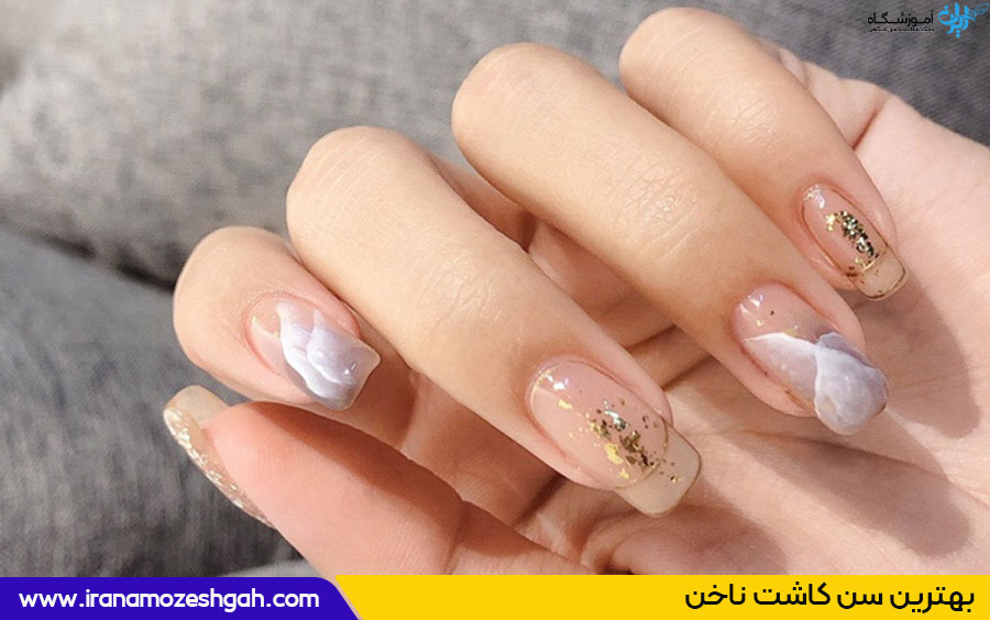 سن کاشت ناخن