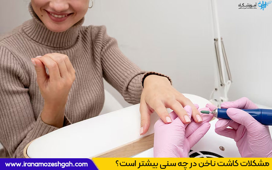 سن کاشت ناخن