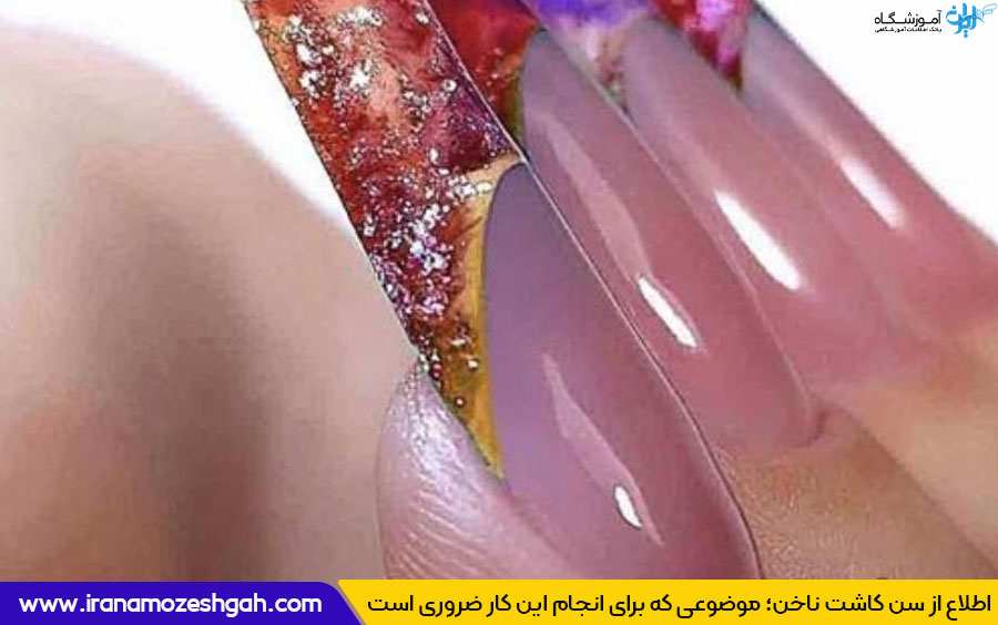 سن کاشت ناخن