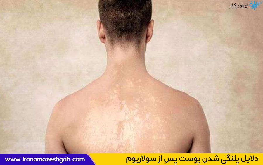 سولاریوم چیست؟ 