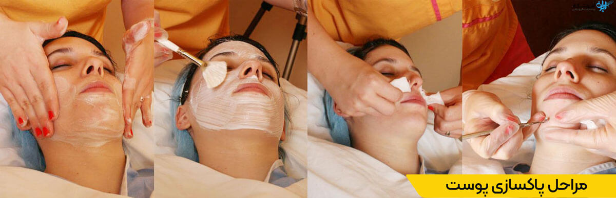 مراحل خدمات سالن پاکسازی پوست