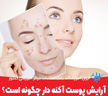 آرایش پوست آکنه دار چگونه است