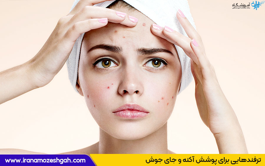 آرایش پوست آکنه