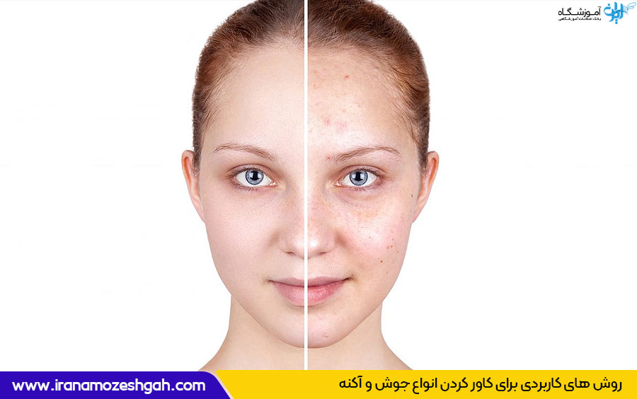 آرایش پوست آکنه دار چگونه است