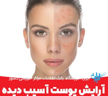 آموزش آرایش پوست آسیب دیده