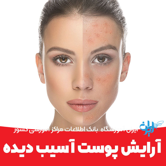 آموزش آرایش پوست آسیب دیده