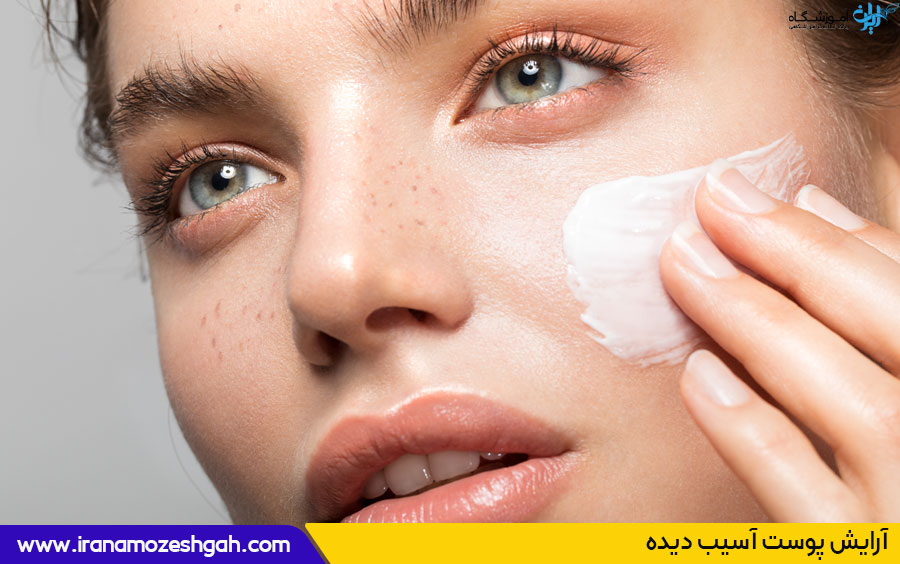 آموزش آرایش پوست آسیب دیده 