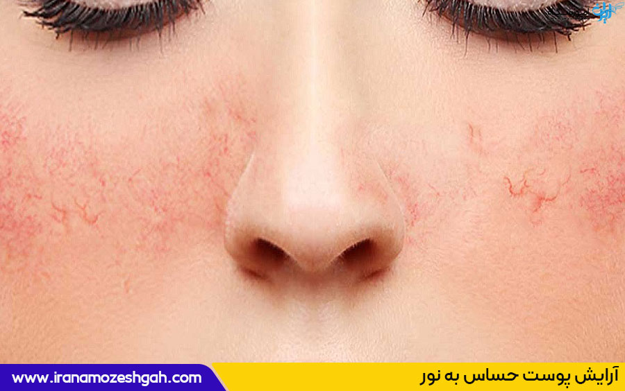 آرایش پوست حساس به نور