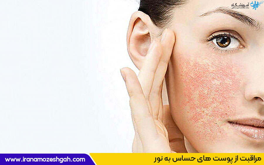 آرایش پوست حساس به نور