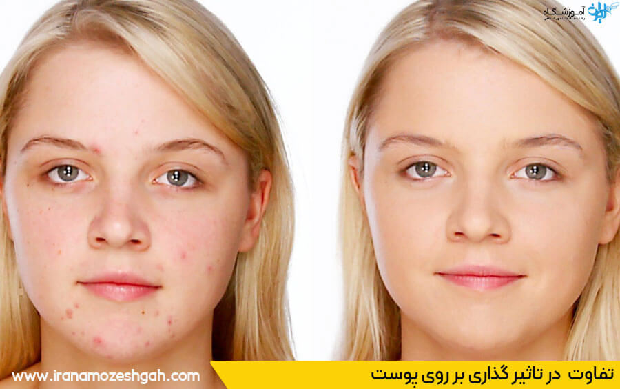 تفاوت فیشیال و پاکسازی پوست