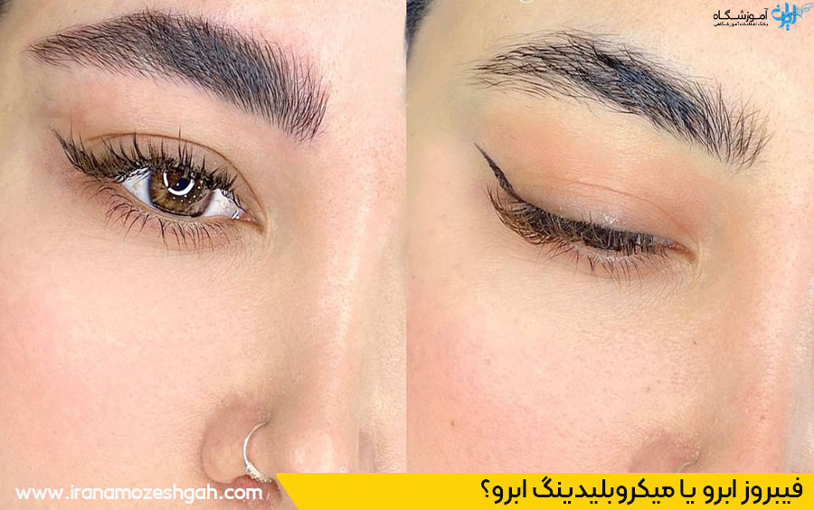 فیبروز ابرو اصفهان