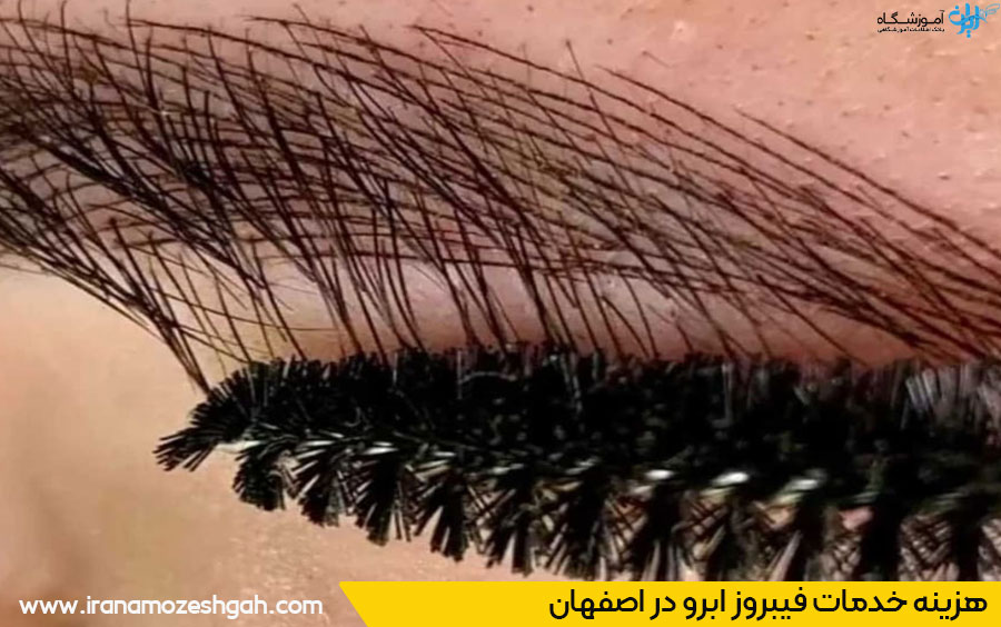 هزینه فیبروز ابرو در اصفهان