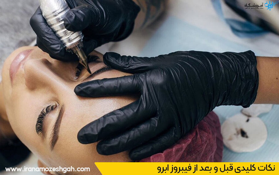بهترین مرکز و سالن فیبروز ابرو مشهد