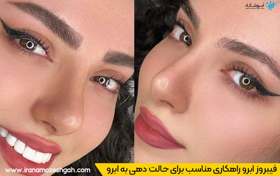 فیبروز ابرو