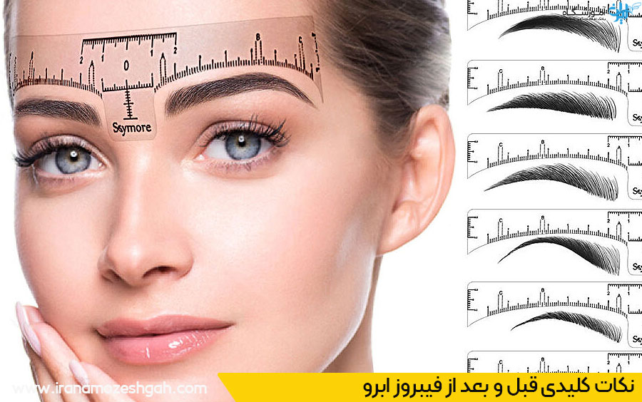 نکات قبل و بعد از فیبروز ابرو