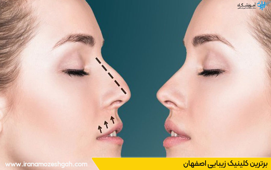 بهترین کلینیک زیبایی اصفهان