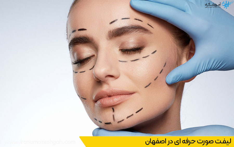 لیفت صورت اصفهان