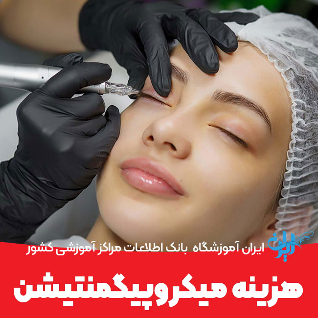 هزینه میکروپیگمنتیشن
