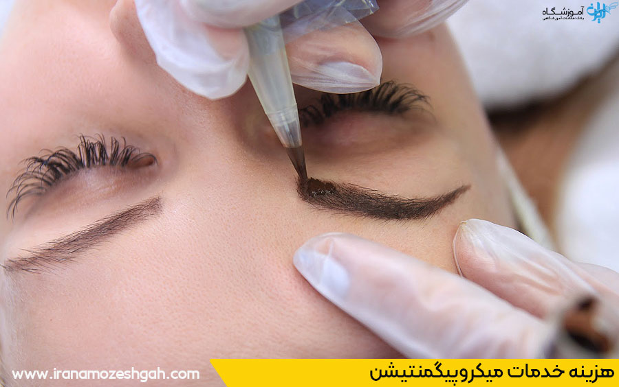 هزینه میکروپیگمنتیشن