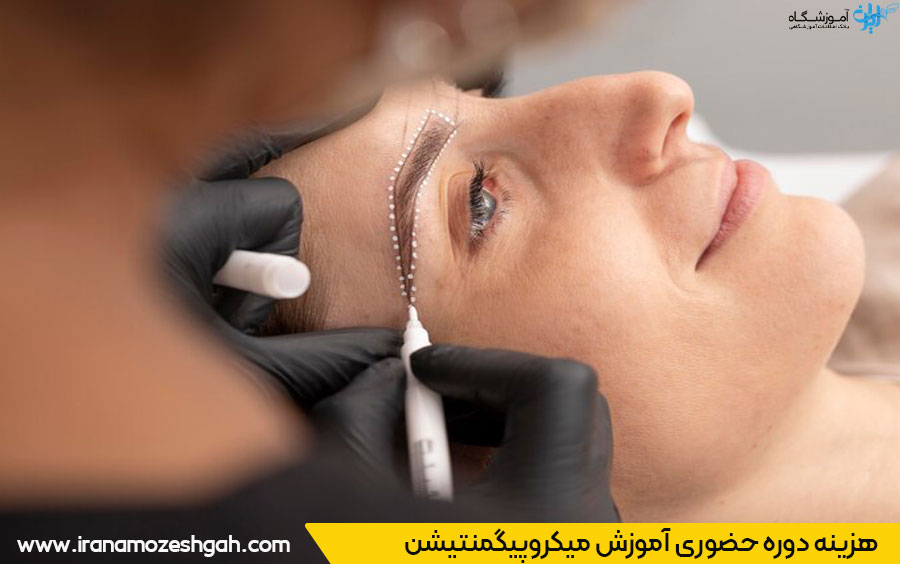 هزینه میکروپیگمنتیشن