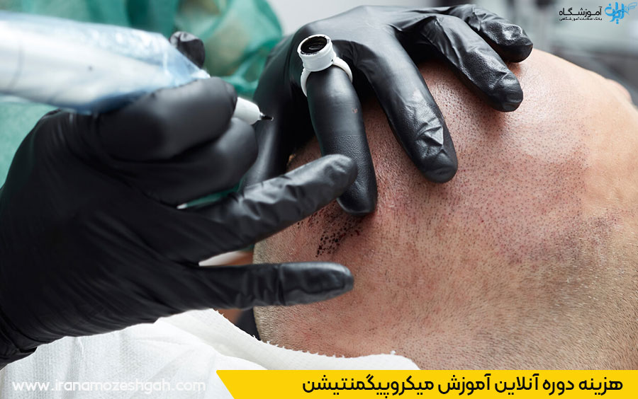 هزینه میکروپیگمنتیشن