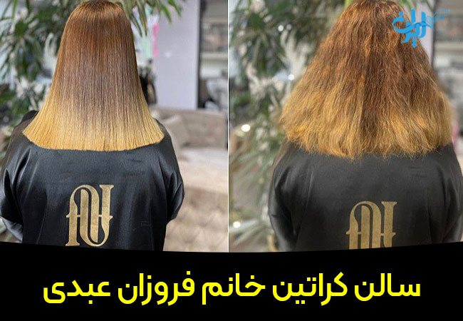 مرکز کراتینه فروزان عبدی