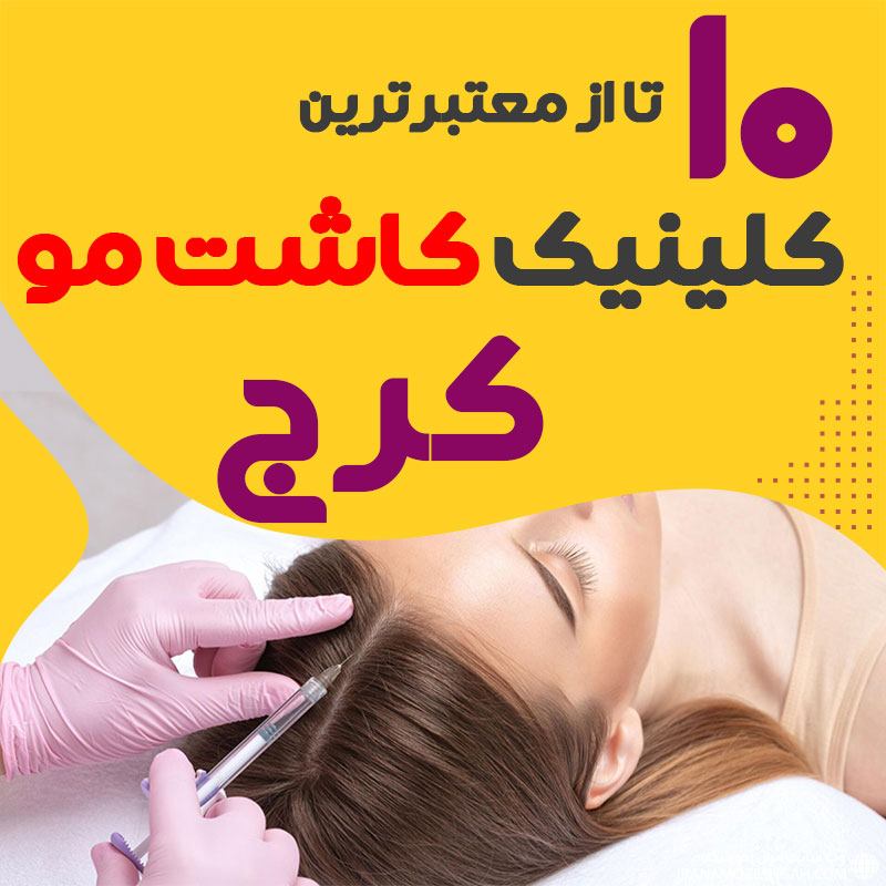 بهترین مراکز کاشت مو کرج
